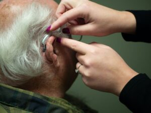  Hearing Aids